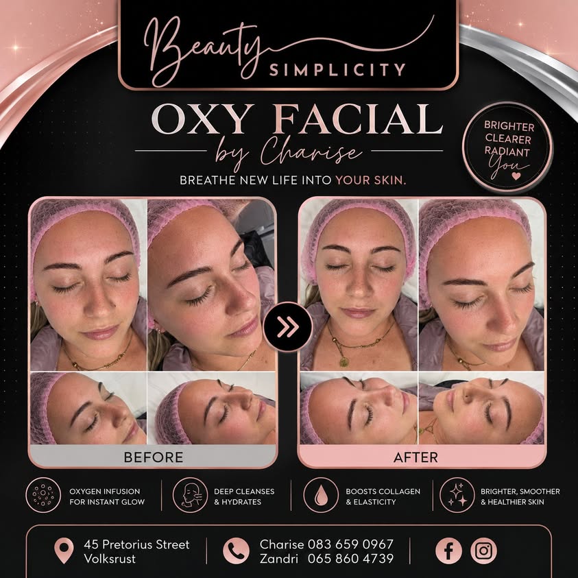 Before and after Oxy Facial by Charise